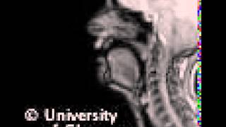 MRI voiceless alveolopalatal fricative [upl. by Durarte]