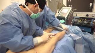 Hi Def Lipo  Fat Transfer to Calves  Calf Liposuction and Mass by Dr Jason Emer [upl. by Buyers]