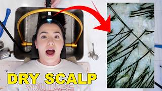 Trying The Viral Scalp Spa  Merrell Twins [upl. by Daugherty]