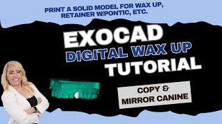 Exocad 32 digital wax up with copy amp mirror [upl. by Sadnak]