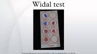 Widal test [upl. by Adniralc200]