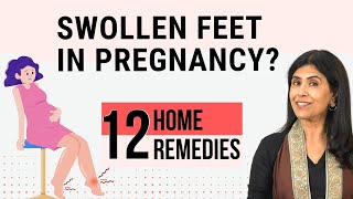 12 Home Remedies for Swollen feet in Pregnancy  Dr Anjali Kumar  Maitri [upl. by Norwood]