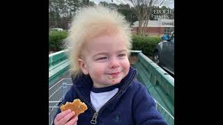 Boy With Rare Uncombable Hair Syndrome Brings a Smile to Faces [upl. by Flaherty]