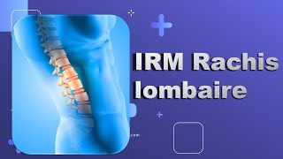 IRM du Rachis lombaire Bonne Pratique [upl. by Means]