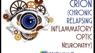 Optic Neuritis Chronic Relapsing Inflammatory Optic Neuropathy [upl. by Willard449]