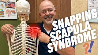 What is Snapping Scapula Syndrome [upl. by Thomajan]