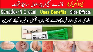 Kanadex N Cream Used For  Kenadex N Cream ke Fayde  Kenadex N Cream Review  Shahzad Pharmacy [upl. by Nodal]