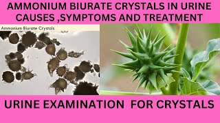 AMMONIUM BIURATE CRYSTALS IN URINECAUSES SYMPTOMS AND TREATMENT OF AMMONIUM BIURATE [upl. by Leffen]