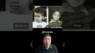 การรักษาที่ถูกแบน Icepick Lobotomy สาระ เรื่องเล่า facts history knowledge lobotomy medical [upl. by Kenweigh]