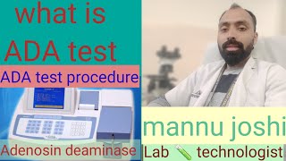 What is ADA  ADA test procedure adenosine deaminase [upl. by Hakvir]