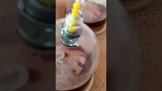 Hijama Raipur No 1 Cupping Clinic [upl. by Sonstrom]