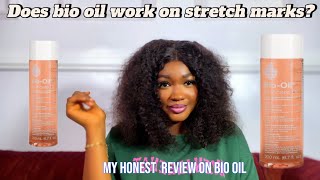 Bio oil review  can bio oil remove stretch mark [upl. by Chuipek]