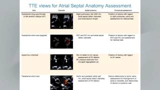 Guidelines for the Echocardiographic Assessment of Atrial Septal Defect amp Patent Foramen Ovale [upl. by Lillis]