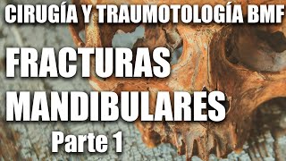 Cirugía y Traumatología Fracturas Mandibulares FOUBA parte 1 [upl. by Lleoj432]