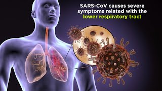 Severe Acute Respiratory Syndrome SARS [upl. by Ittak]