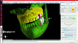 CURSO ¬ Tomografia Cone Beam Dental e Impresión 3D en Odontología Digital [upl. by Ellahcim]