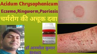 Acidum Chrysophanicum 302001MRingwormEczemaAcnePsoriasisदाद खाजखुजलीDr Anmol [upl. by Meerak599]