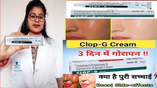 Clobetasol Propionate and Gentamicin Cream  Clop g Cream honest reviewClop g Cream benefits uses [upl. by Esina]