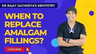 Should I replace my amalgam fillings Amalgam vs composite resin  Rajat Sachdeva delhi dentist [upl. by Cloots305]