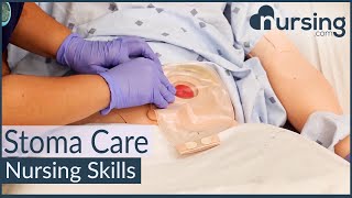 Stoma Care Changing a Colostomy Bag Nursing Skills [upl. by Muriah]