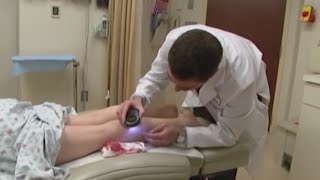 Kaiser Doctor on the Importance of Skin Protection During Melanoma Awareness Day [upl. by Gamber]