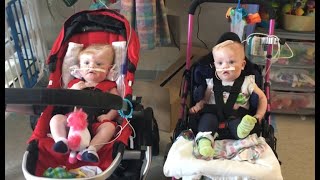 Formerly conjoined twins doing well after separation [upl. by Reinert]