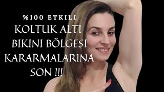 100 ETKİLİ KOLTUK ALTI BİKİNİ BÖLGESİ BEYAZLATMA YÖNTEMİ KOLTUK ALTI KARARMASINA ETKİLİ ÇÖZÜM [upl. by Rollins]