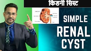 Simple Renal cyst  POLYCYSTIC KIDENY DISEASE IN HINDI [upl. by Hak]