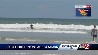 Surfer bitten in the face by shark in New Smyrna Beach [upl. by Arianna]