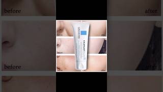 Viral Skincare Tested Is Cicaplast Balm Worth the Hype  Doctorly Reviews [upl. by Flanigan453]