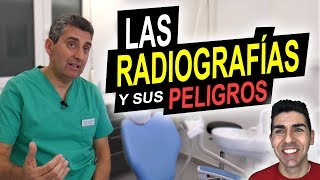 LAS RADIOGRAFÍAS Y SUS PELIGROS  ¿Producen cáncer ¿Debemos evitar las radiografías dentales [upl. by Kylah]