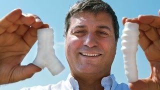 Paolo Macchiarini A surgeon’s downfall [upl. by Lemak411]