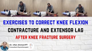 Top Exercises to Fix Limp Flexion Contracture amp Weak Quads After Knee Surgery  Urdu  Hindi [upl. by Arjan165]