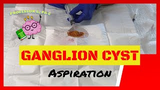 Ganglion Cyst Aspiration on a Homemade Demo [upl. by Hose]