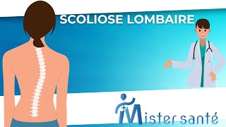 scoliose lombaire causes symptômes et traitements [upl. by O'Hara793]