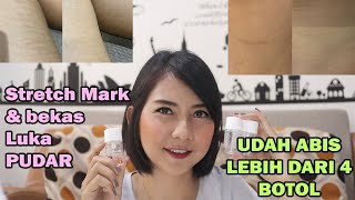 Review BIO OIL stretch mark bekas luka pudar semua [upl. by Vena215]