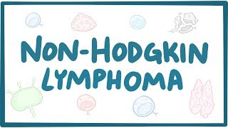 Nonhodgkin lymphoma  causes symptoms diagnosis treatment pathology [upl. by Nehgaem]