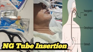 NASOGASTRIC TUBE INSERTION RYLES TUBE FEEDING PROCEDUREFEEDING TUBENG TUBE BENGALI LANGUAGE [upl. by Mcclenaghan]