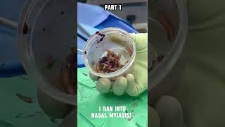 Nasal Myiasis or Nasal Maggots [upl. by Einitsed]