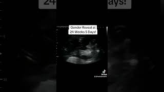 Gender Reveal at 24 Weeks 5 Days Pregnant Book your inhome ultrasound today wwwHeyBabyMobilecom [upl. by Aicetel]