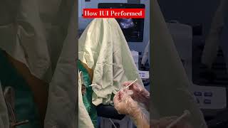 IUI Procedure  intrauterine insemination  by Dr Rakshita Malik ivf medical mbbs ivfclinic [upl. by Avie697]