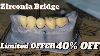 Zirconia Bridge PriceZirconia Bridge ProcedureZirconia PreparationZirconia Fixed BridgeCost [upl. by Sharla]