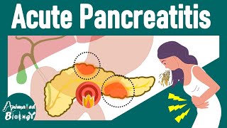 Acute Pancreatitis  Pathology and treatment of Acute Pancreatitis  USMLE step 1 [upl. by Nnaira]