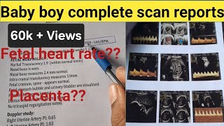 Baby boy complete scan reportsfull explained about Placenta and FHR in kannada [upl. by Jadd]