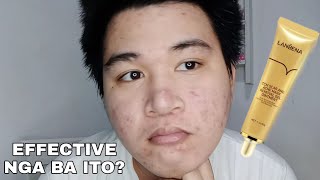 Using LANBENA Scar and Acne Mark Removal Gel Ointment for a Week  REVIEW [upl. by Attinahs]