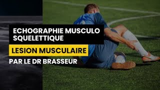 LESION MUSCULAIRE  Echographie Musculo squelettique par le Dr Brasseur [upl. by Nollahp]