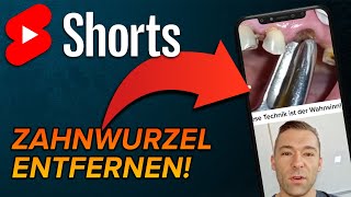 Wurzel ziehen shorts [upl. by Lionello]