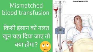 MISMATCHED BLOOD TRANSFUSION hindi [upl. by Comethuauc]