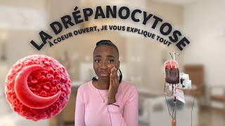 LA DRÉPANOCYTOSE À COEUR OUVERT  JE VOUS DIS TOUT [upl. by Wey]