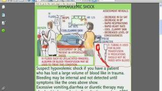 SESSIONS for NURSES 9  THE PATIENT IN HYPOVOLEMIC OR SPINAL SHOCK [upl. by Ailyn225]